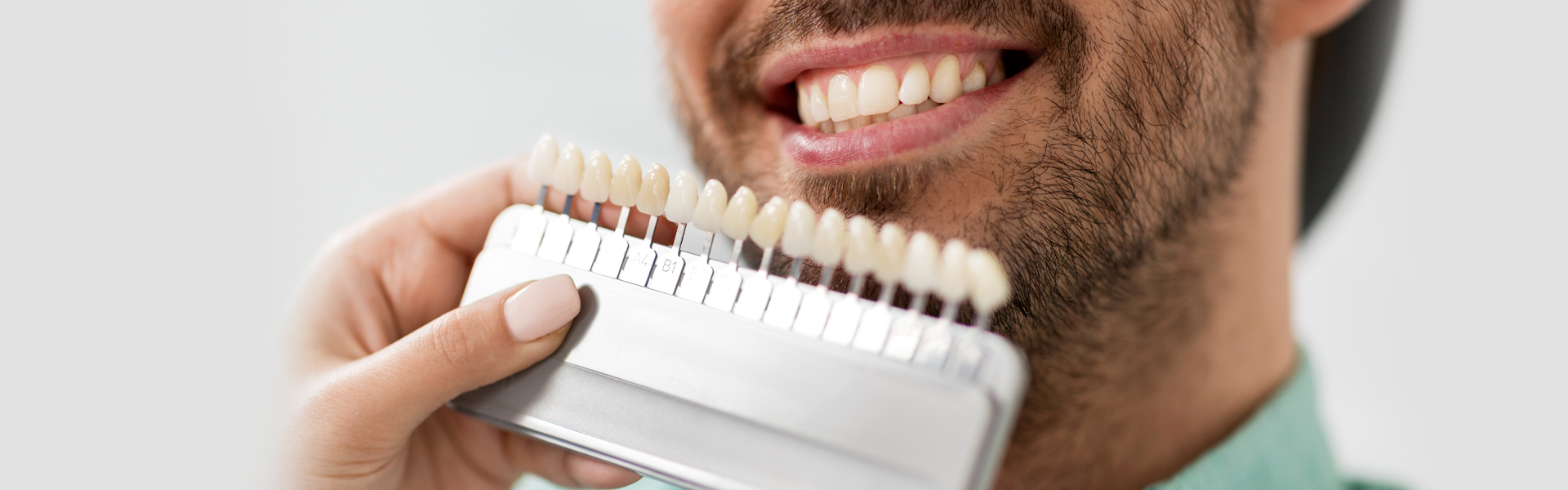 Dental Veneers: Easy & Pain-free Process for Reshaping your Smile