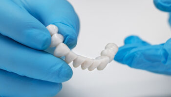5 Things To Know Before Considering a Dental Bridge